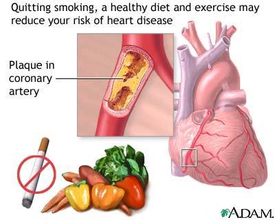 Heart dieaase risk factors