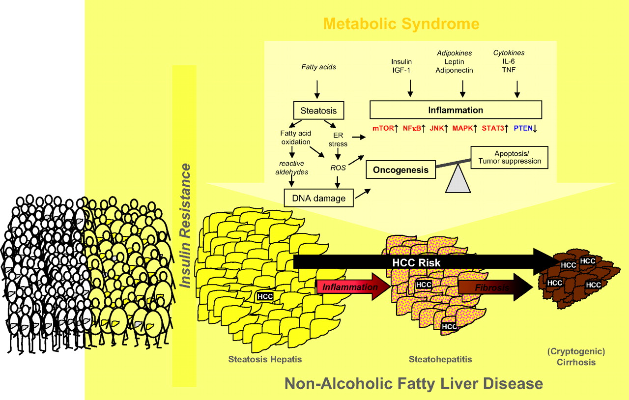Non-alcoholic Fatty Liver Disease