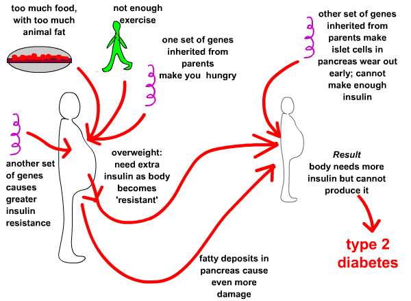 Causes of Type 2 diabetes,  http://www.usernetsite.com/society/type-2-diabetes-and-how-can-be-cured-or-treatedu.php