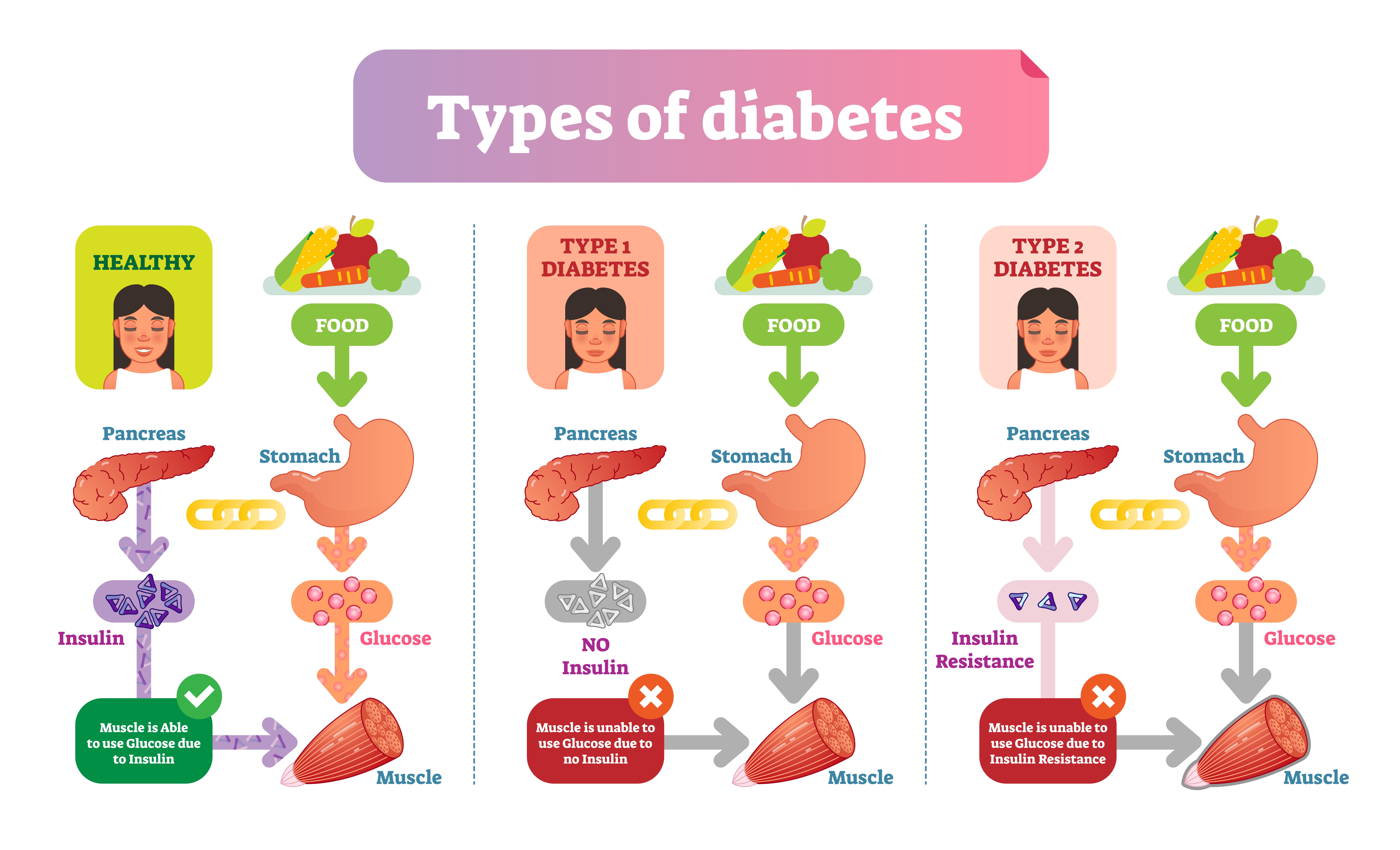 Type 1 and Type 2 Diabetes