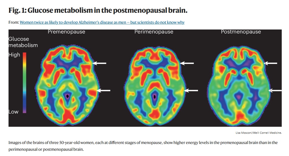 Glucose use by female brains