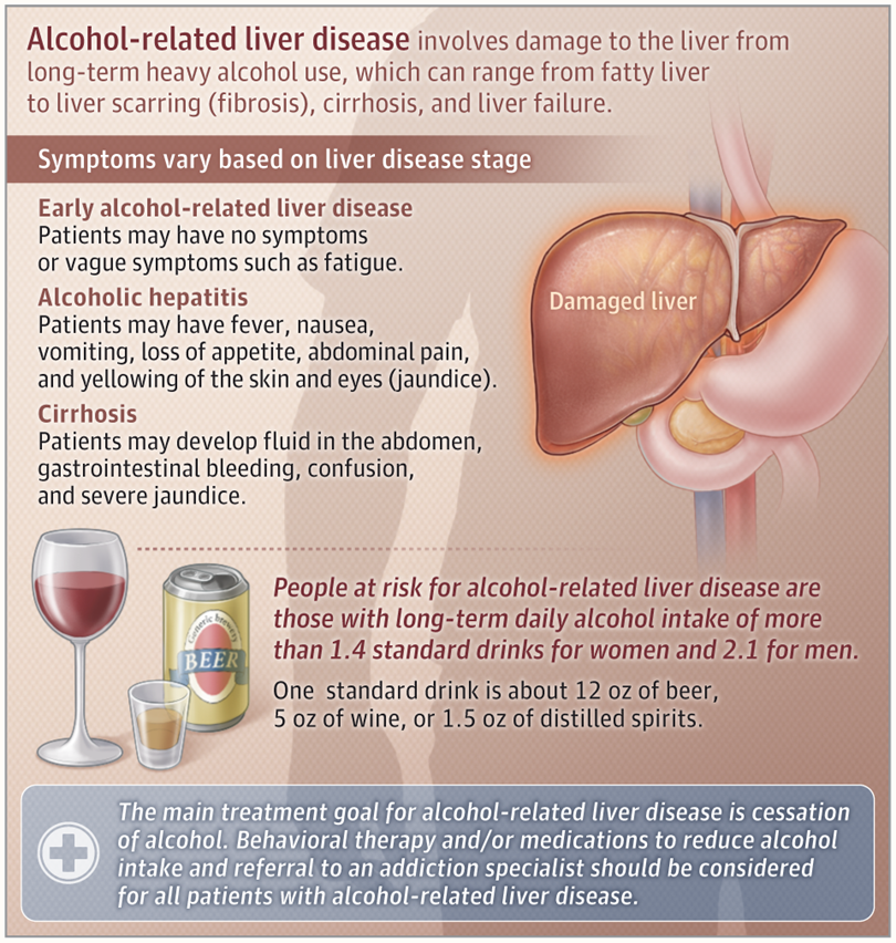 Alcoholic LIver Disease