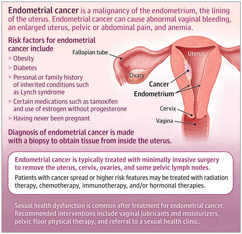 Endometrial Cancer - Patient Page