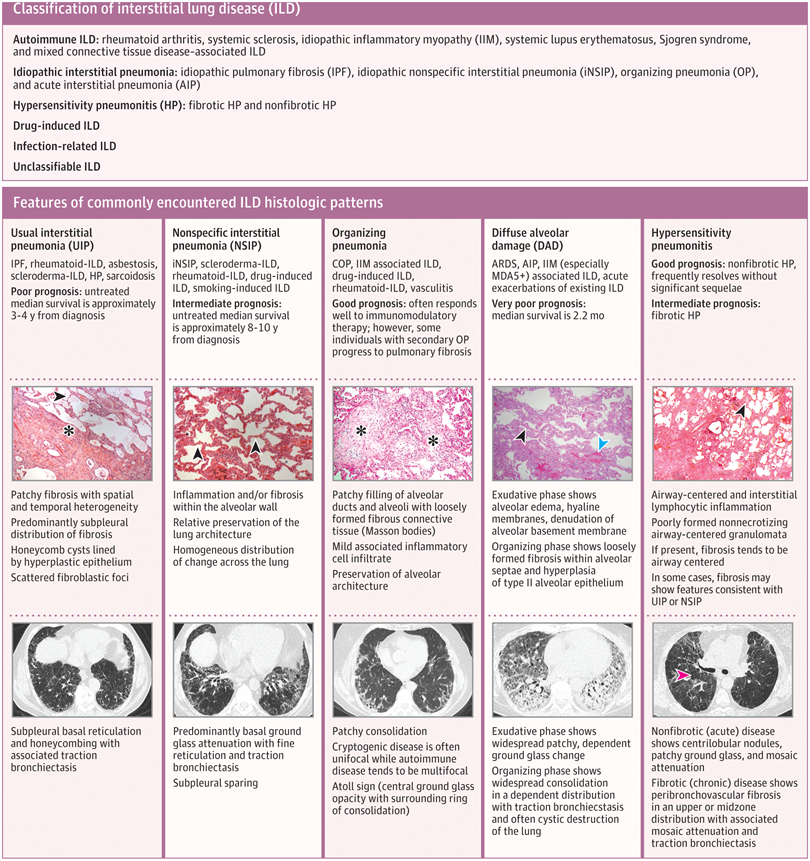 Lung disease
