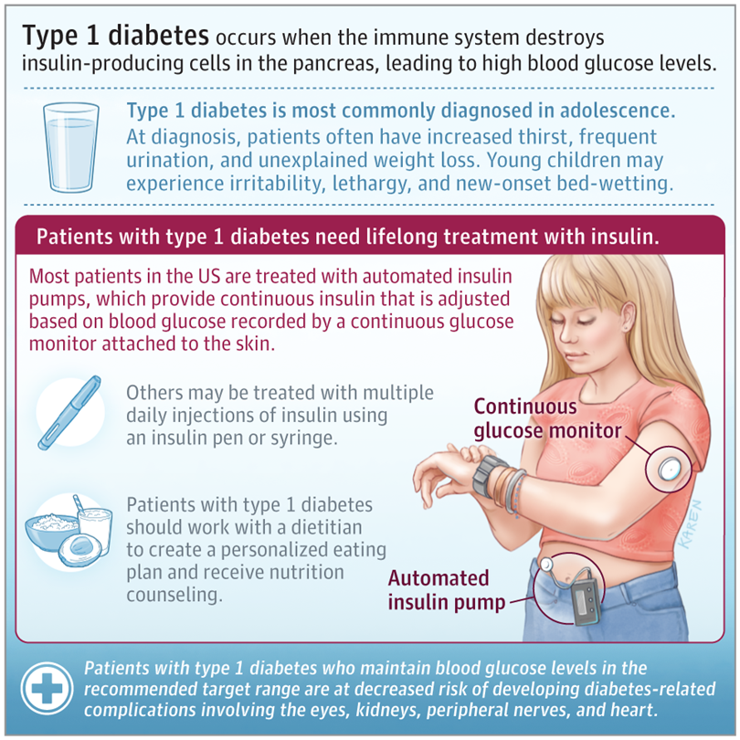 Type 1 Diabetes, basics